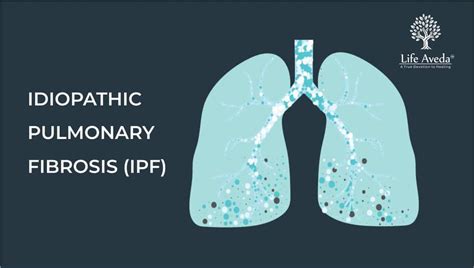 IPF Treatment